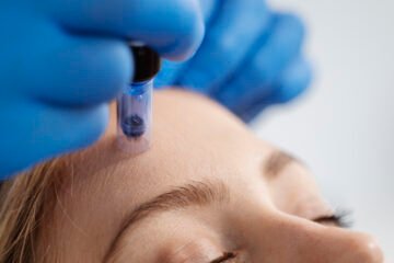 Treatment in progress