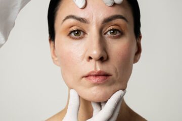 Profhilo Treatment