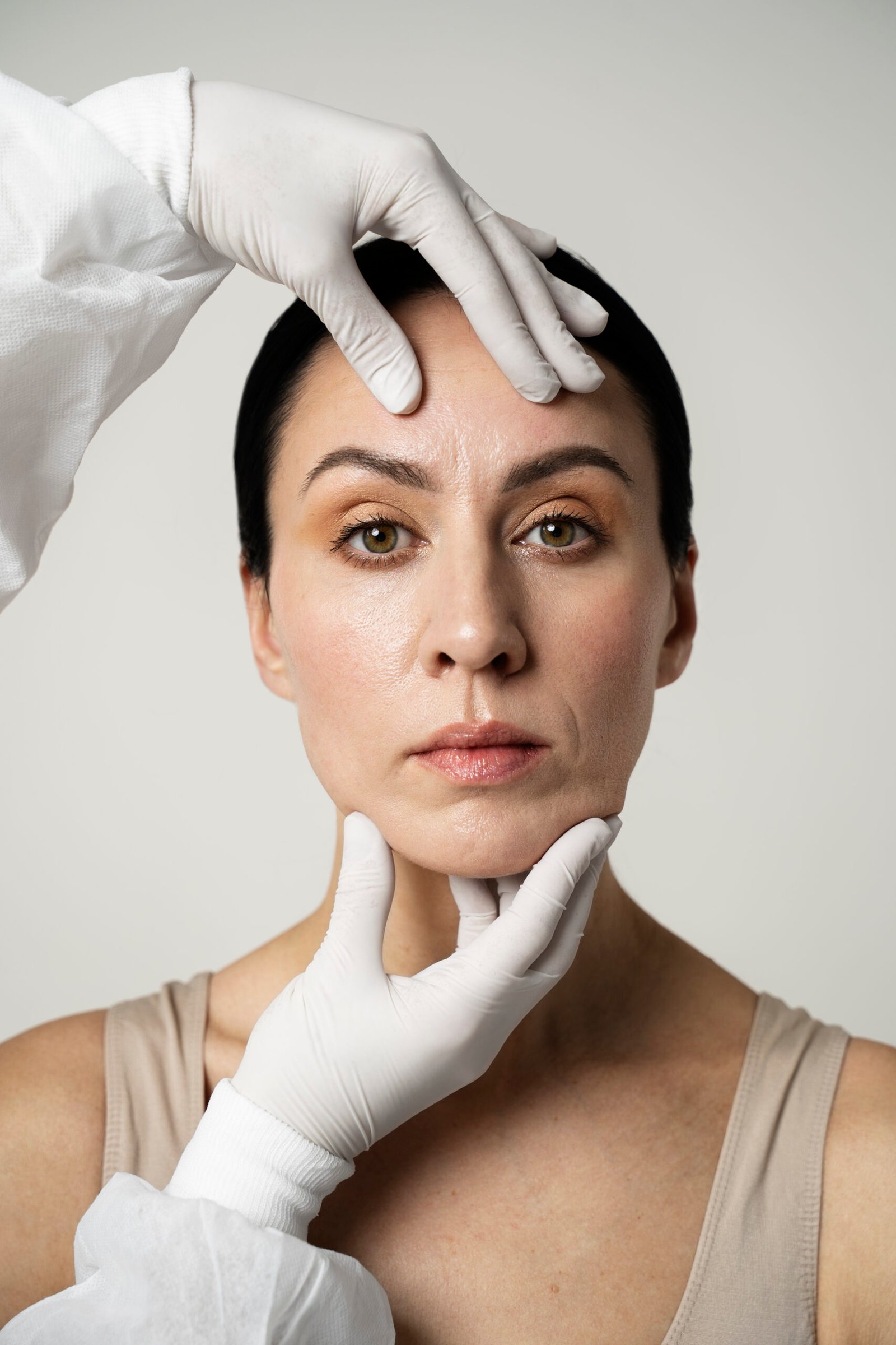 Profhilo Treatment